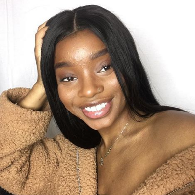 Acne Is Normal: Nazhaya