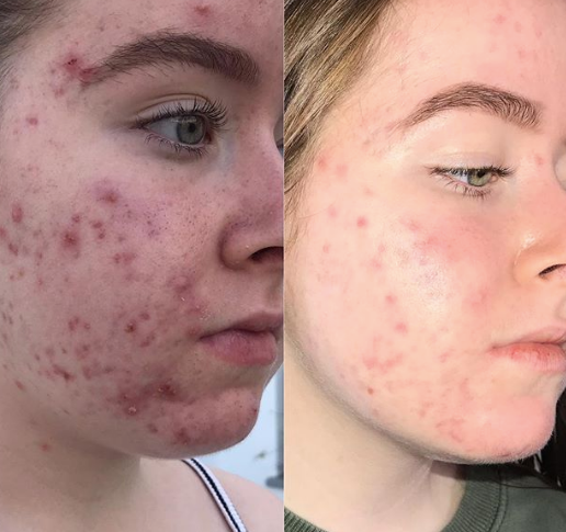 Dealing With Pt. 2: Emma Taylor