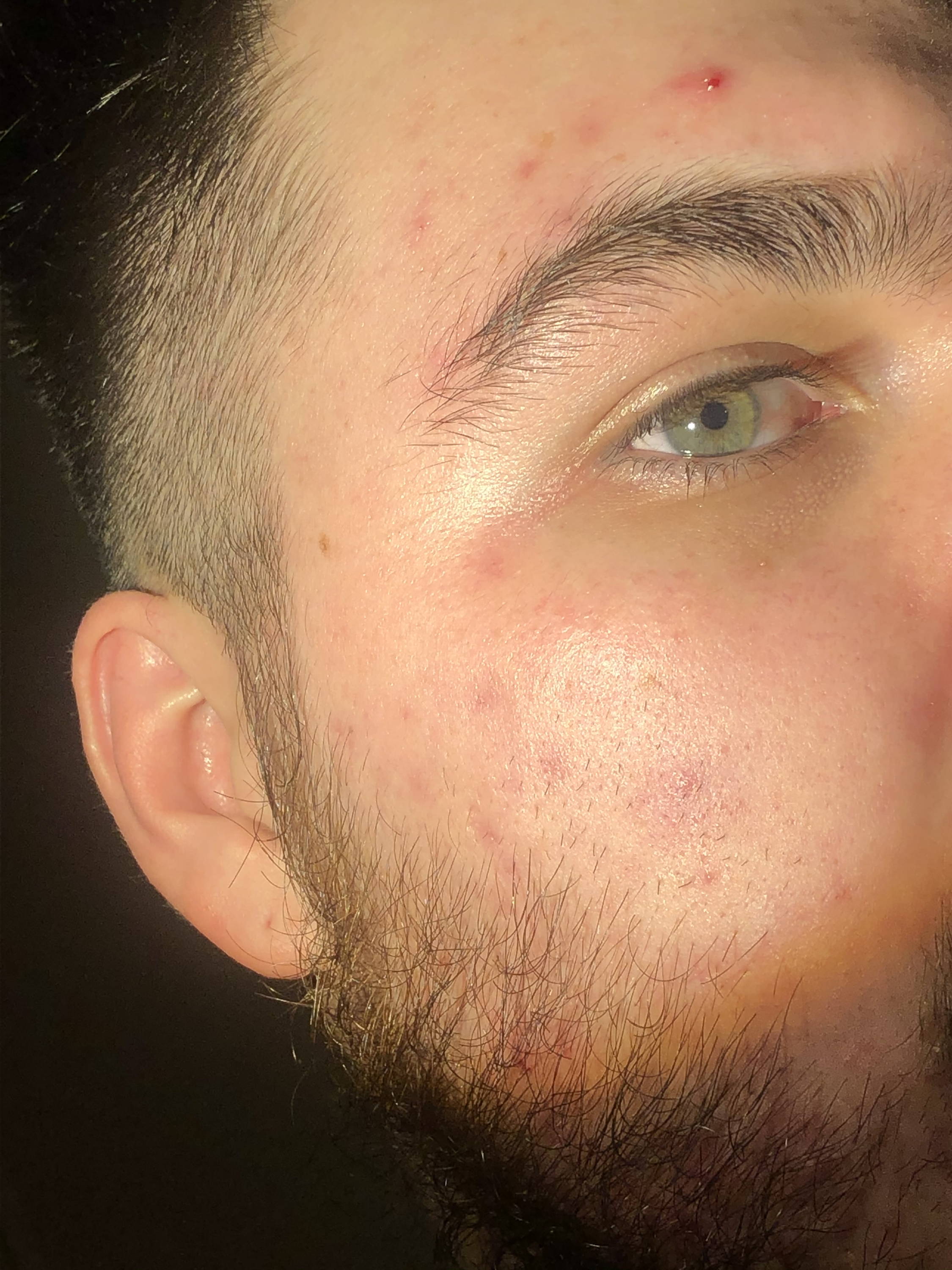 Becoming Little Crusty