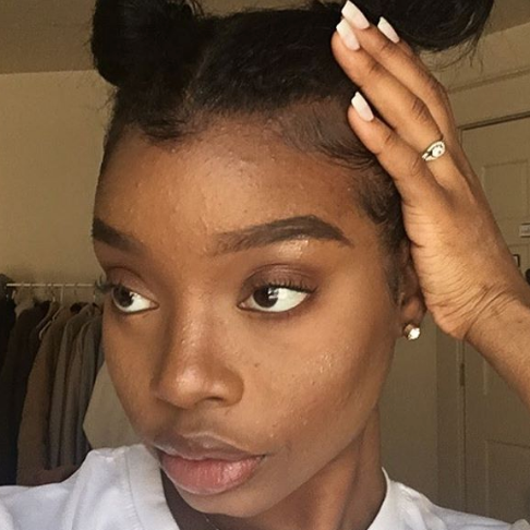 Acne Is Normal Pt 2: Becoming @theacneaesthetic