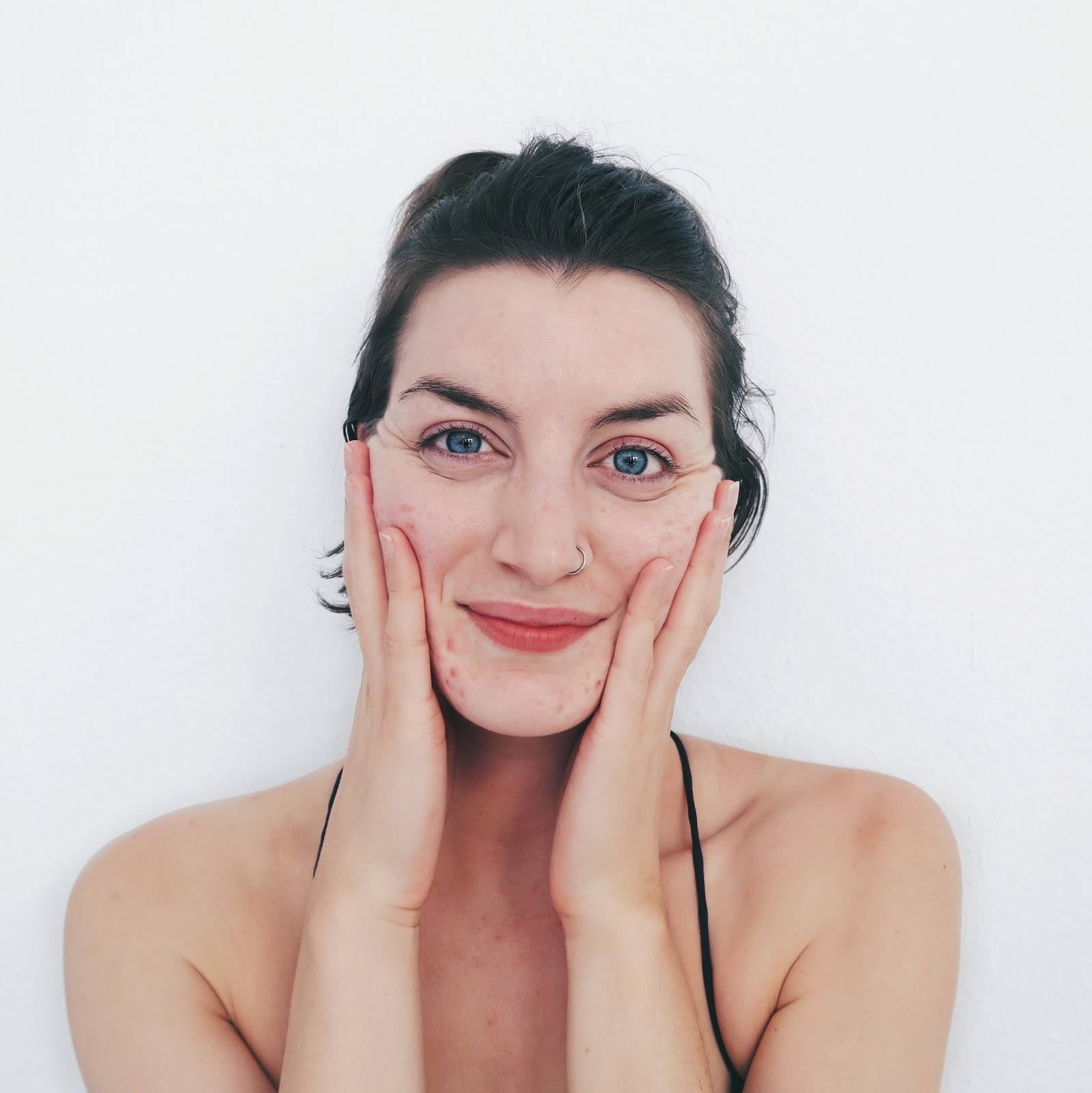 Acne is Normal: Skin with Lea Pt. 4