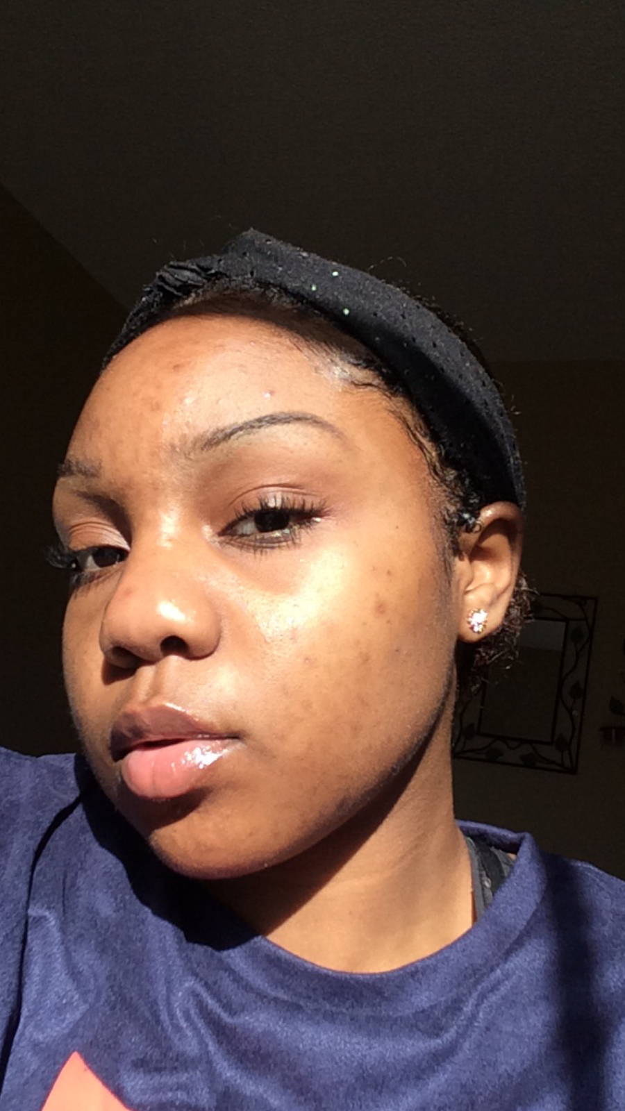 My Skin Journey: Jada B